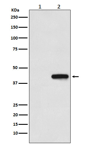 Western blot analysis of His-tagged protein expression in (1) 293T cell lysate; (2) 293T cell transfected with His-tagged protein lysate.