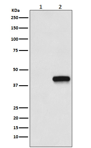 Western blot analysis of Flag-tagged protein expression in (1) 293T cell lysate; (2) 293T cell transfected with Flag-tagged protein lysate.