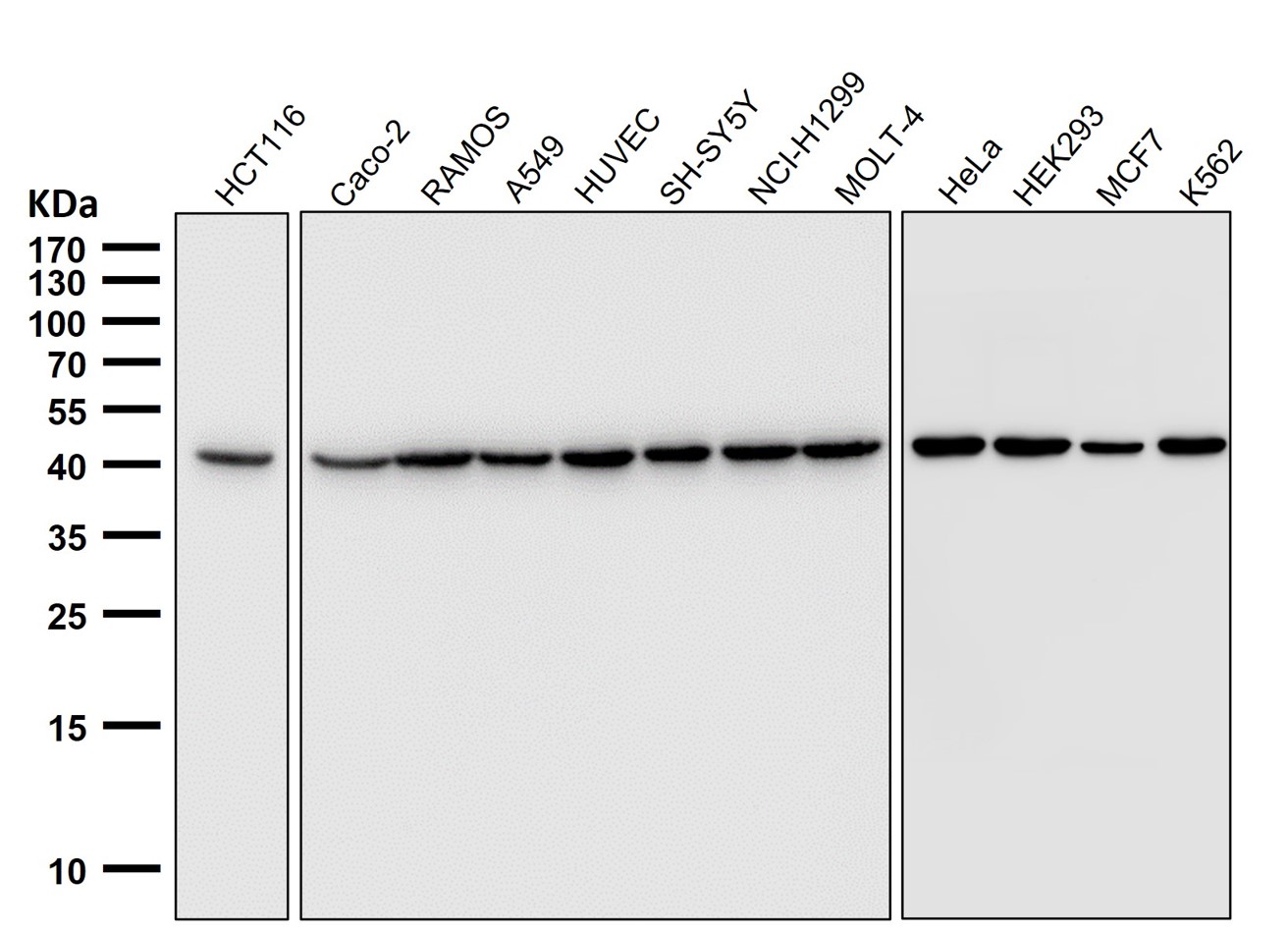All lanes use AB0035 beta Actin Antibody at 1:50000 dilution for 1 hour at room temperature.