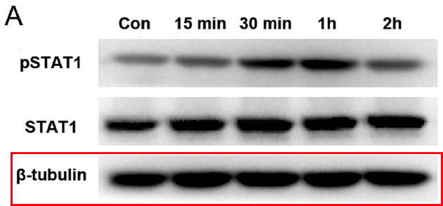 Remifentanil upregulates hepatic IL-18 binding protein (IL-18BP) expression through transcriptional control. -Laboratory Investigation