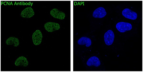 Immunofluorescent analysis of Hela cells, using PCNA Antibody.