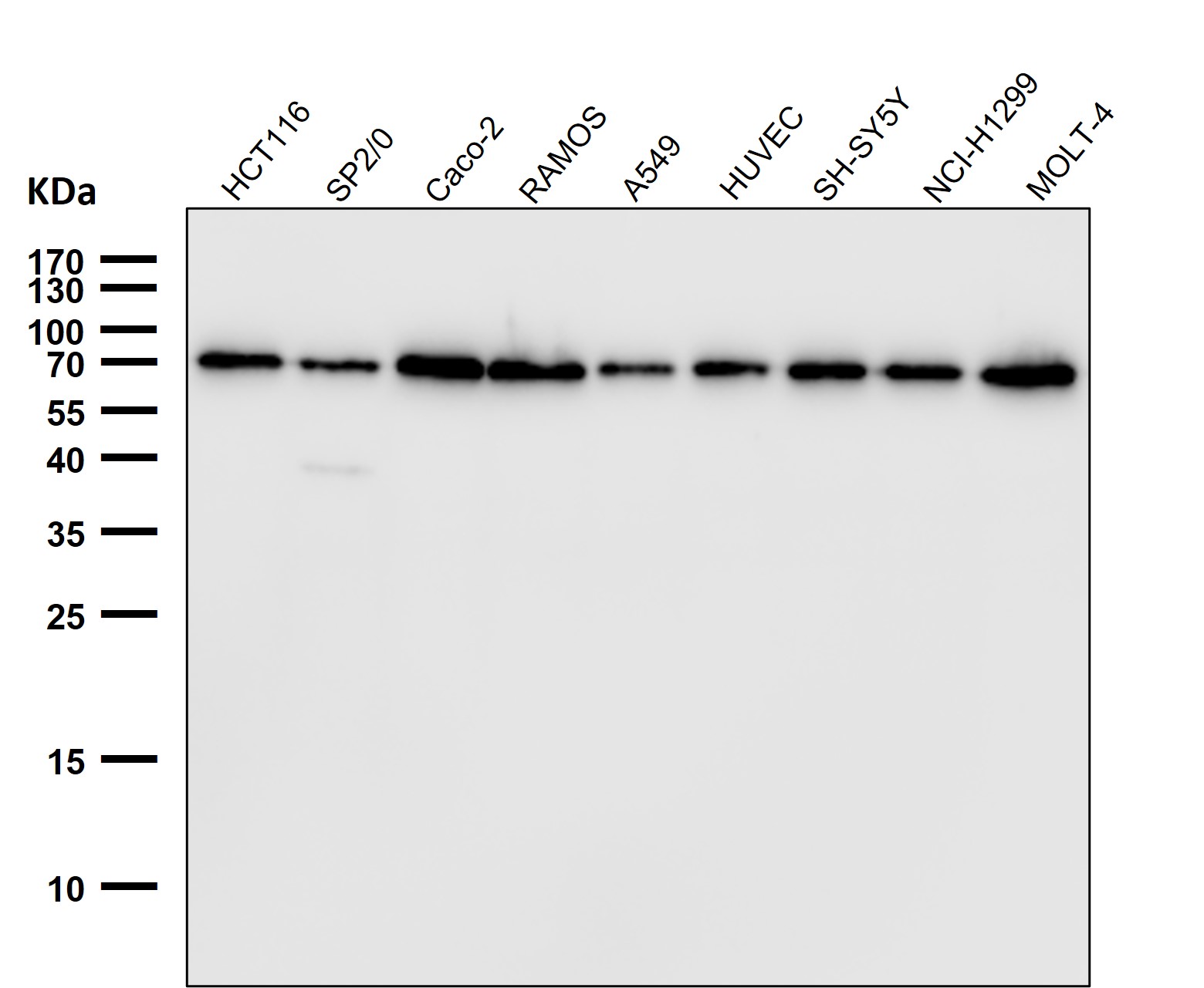 All lanes use AB0054 Lamin B1 Antibody at 1:10000 dilution for 1 hour at room temperature.