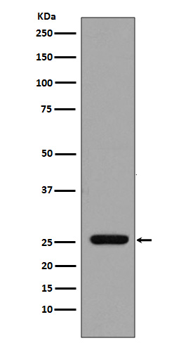 Western blot analysis of GST expression in GST recombinant protein.