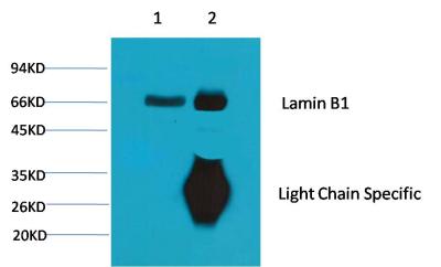 Immunoprecipitation analysis of Lamin B1 (9B10) in Mouse Brain lysates using Lamin B1 (9B10) antibody.