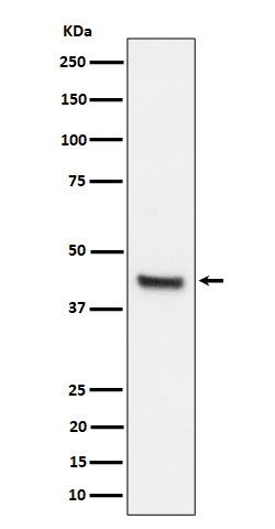Western blot analysis of IL11RA expression in 293T cell lysate.