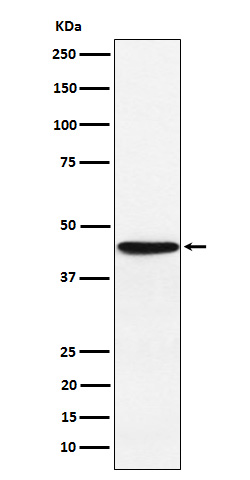 Western blot analysis of HLA F expression in JAR cell lysate.