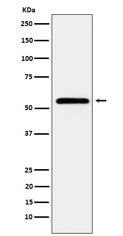 Western blot analysis of CaMKII expression in HeLa cell lysate.