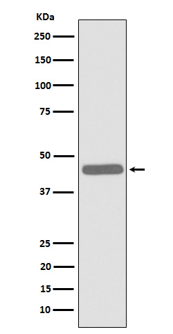 Western blot analysis of ALKBH1 expression in Jurkat cell lysate.