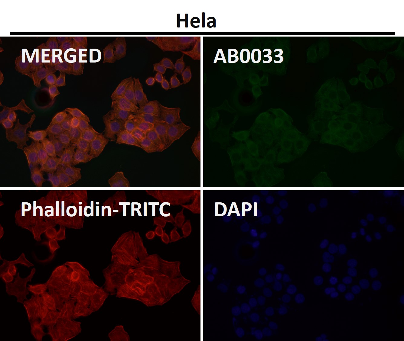 alpha Skeletal muscle actin Ab