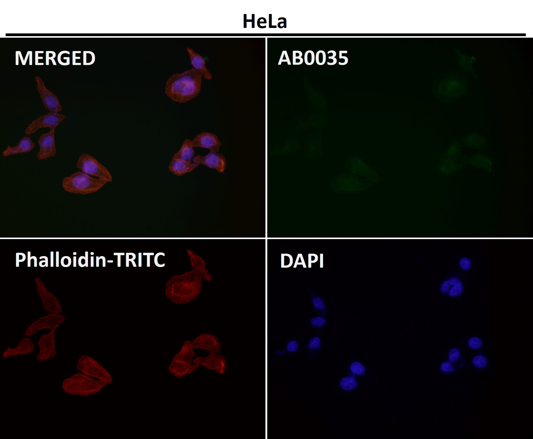 beta Actin Ab