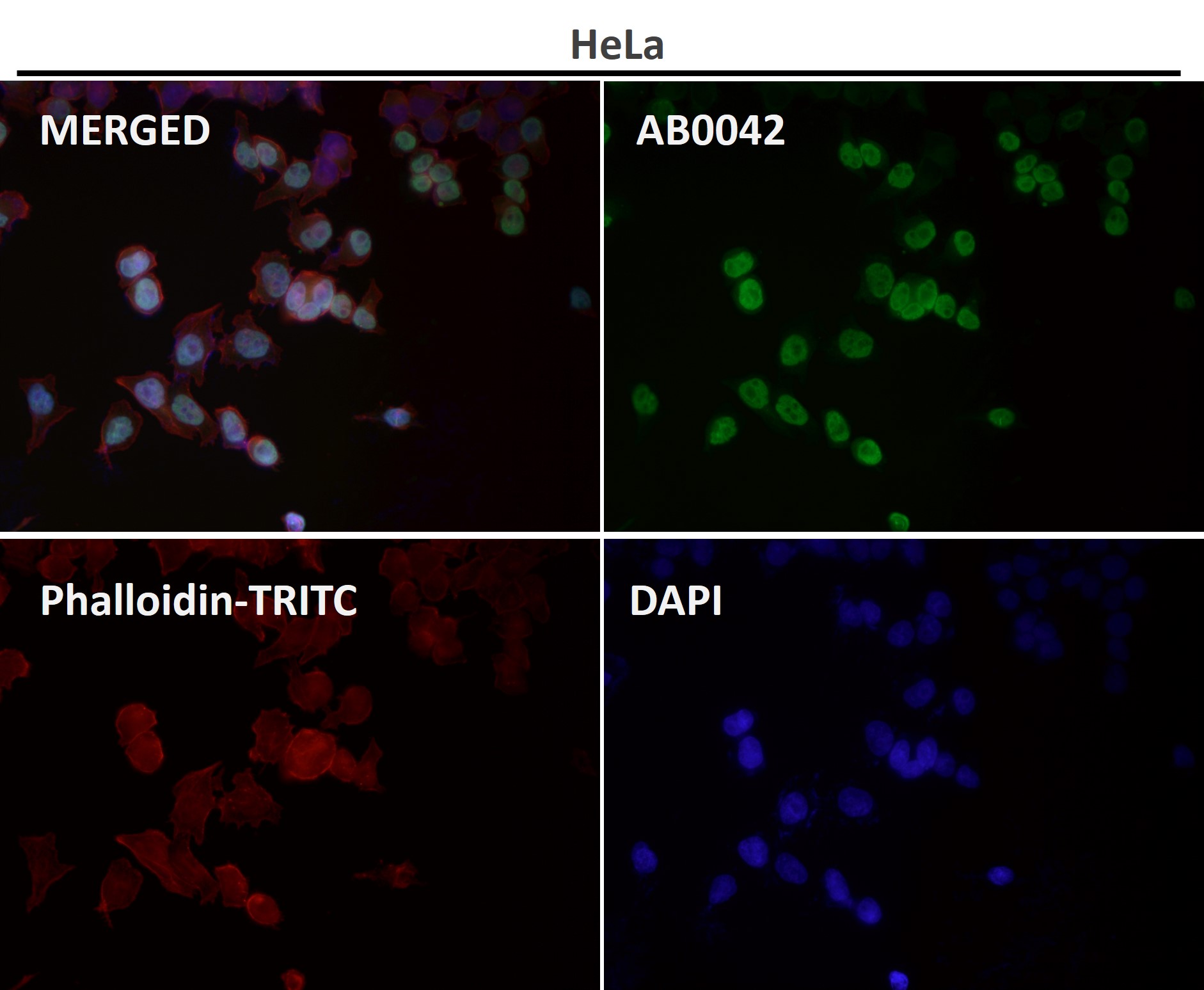 beta Tubulin Ab