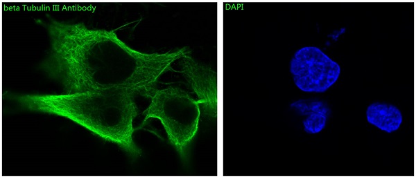 beta Tubulin Ab