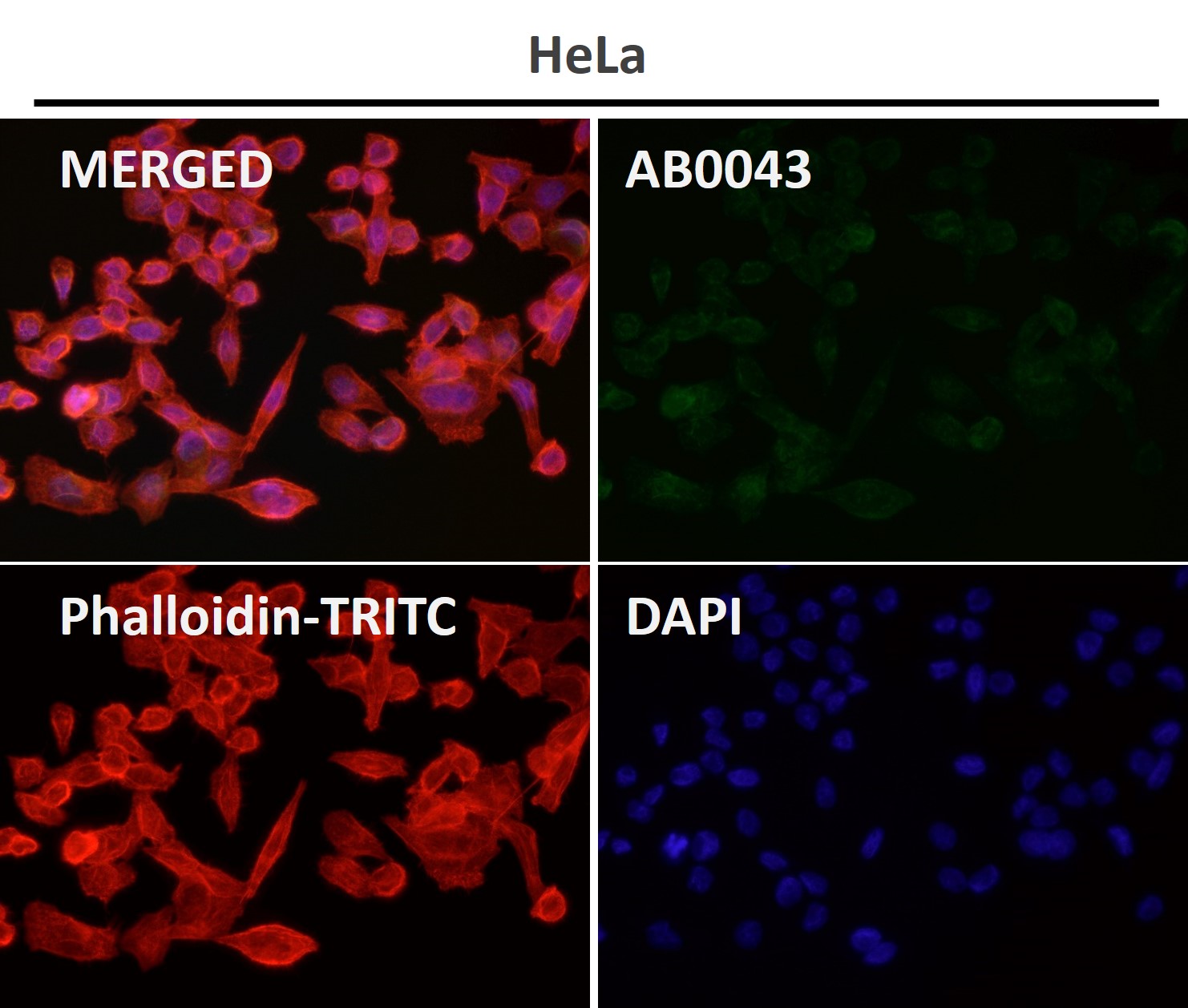 beta III Tubulin Ab