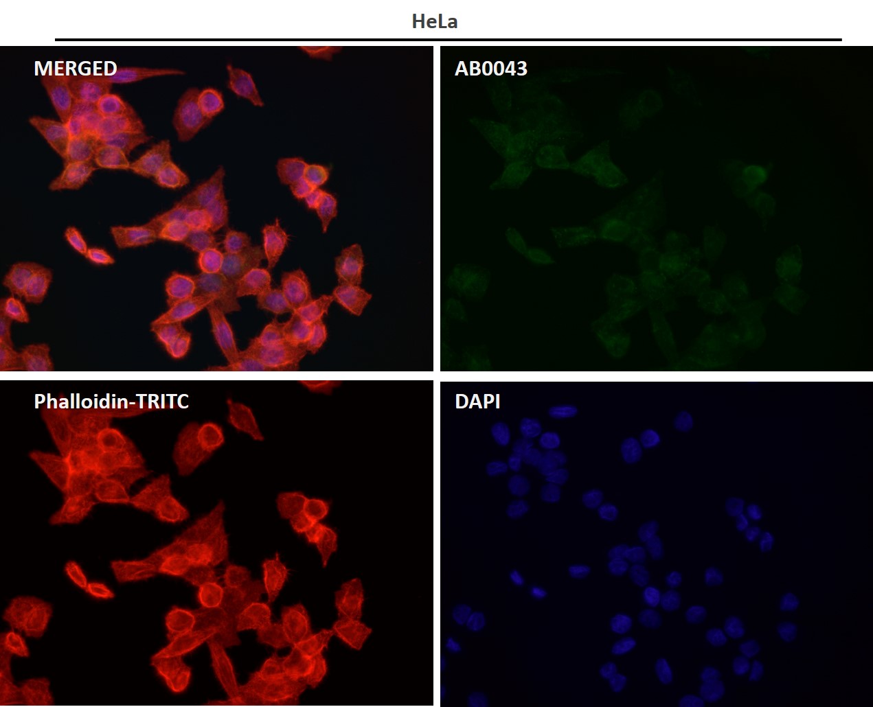 beta III Tubulin Ab