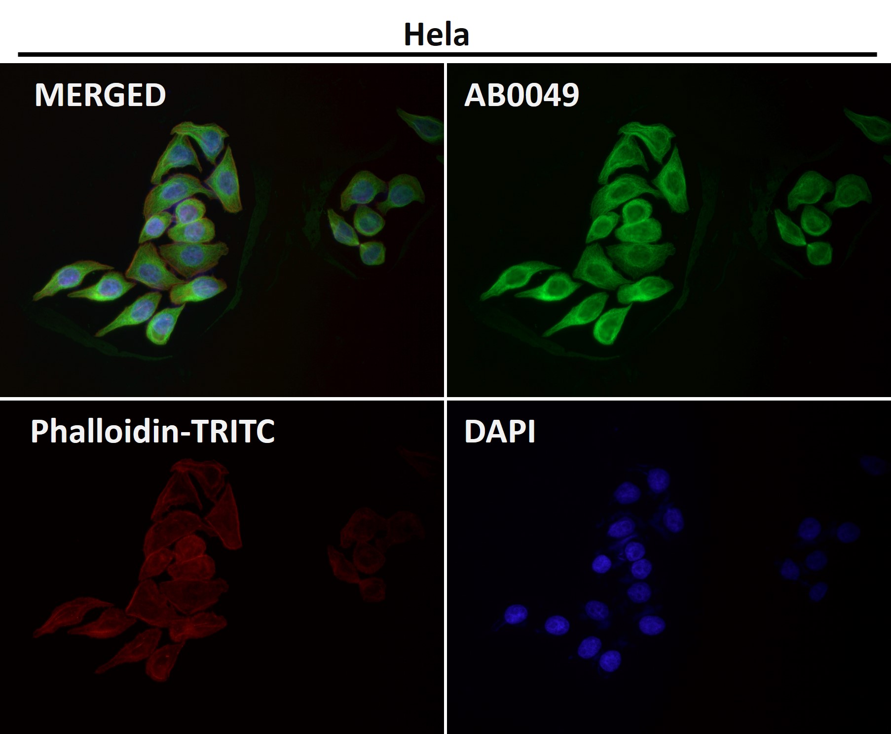 alpha 4A Tubulin Ab