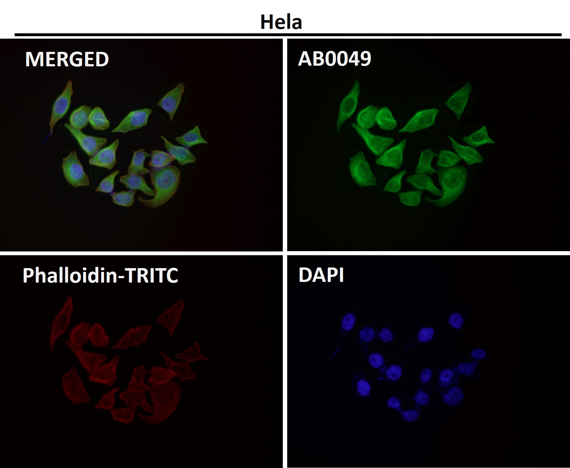 alpha 4A Tubulin Ab