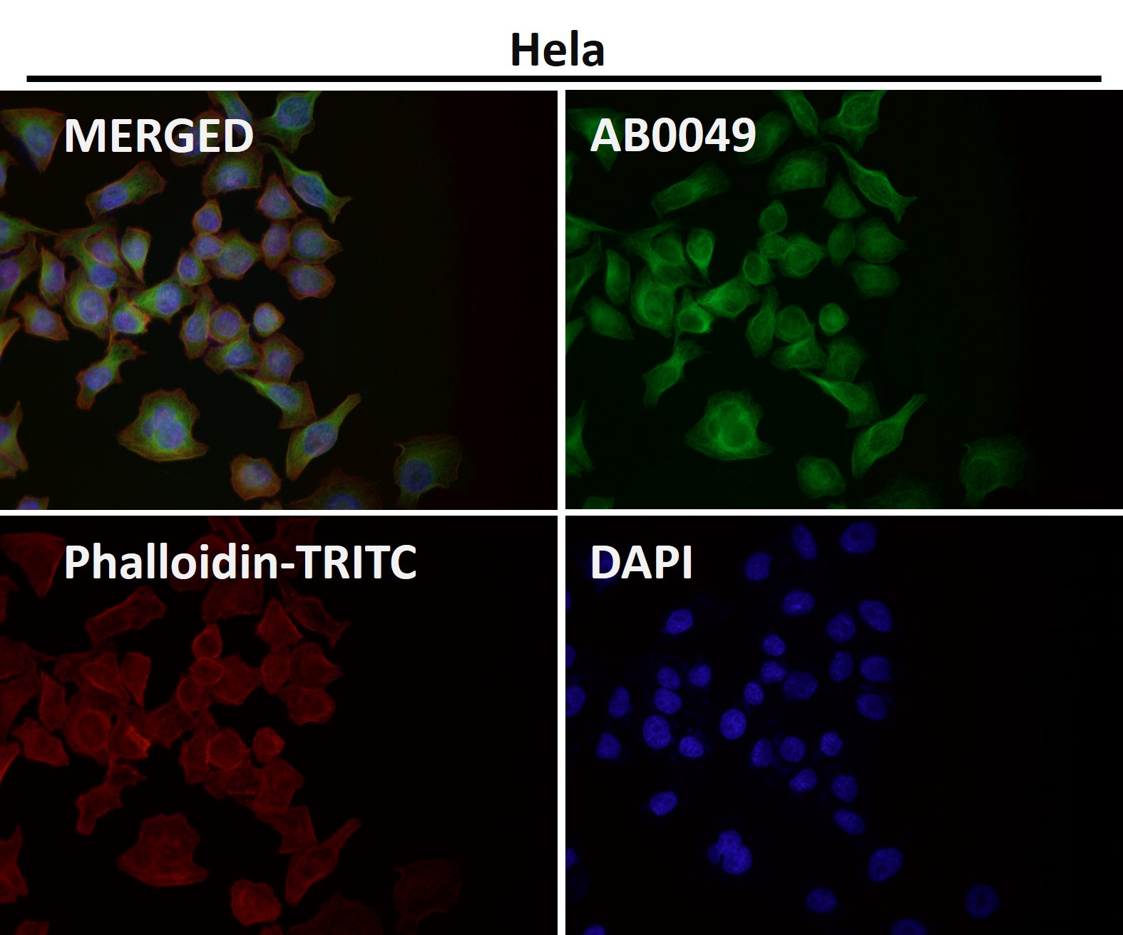 alpha 4A Tubulin Ab