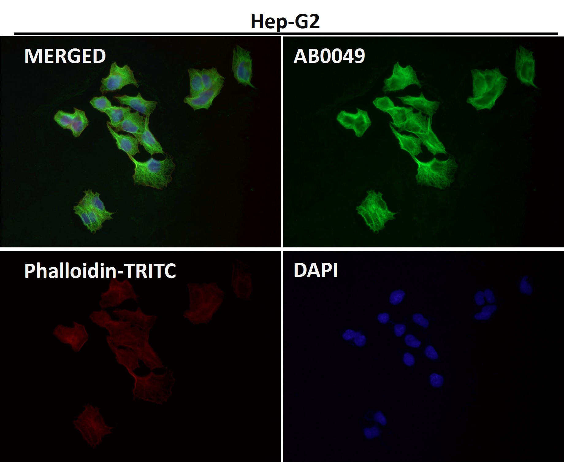 alpha 4A Tubulin Ab