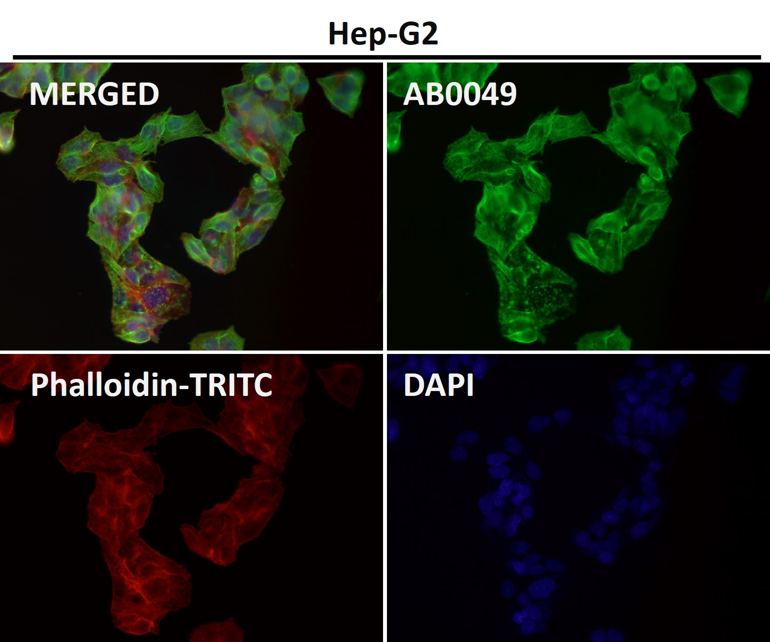 alpha 4A Tubulin Ab