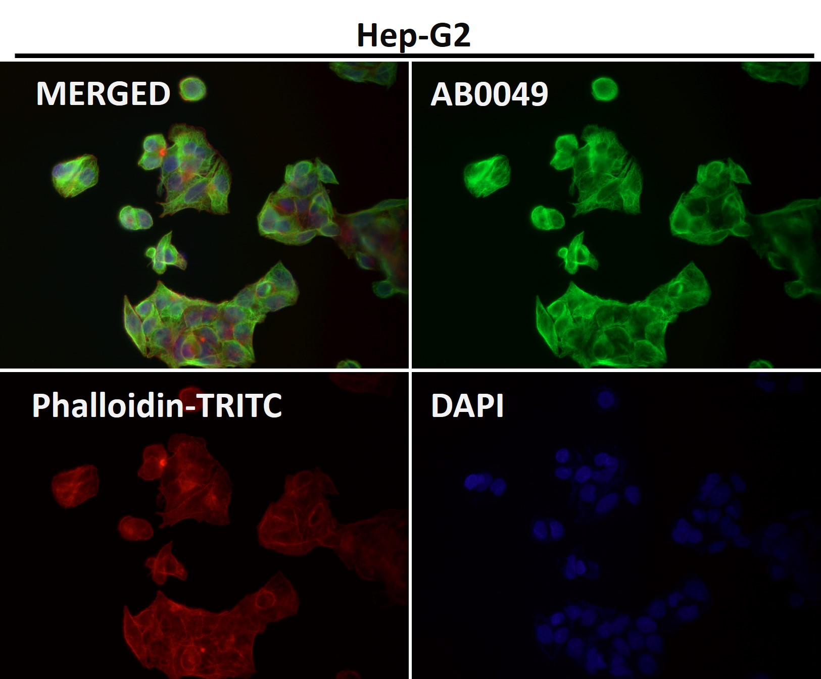 alpha 4A Tubulin Ab