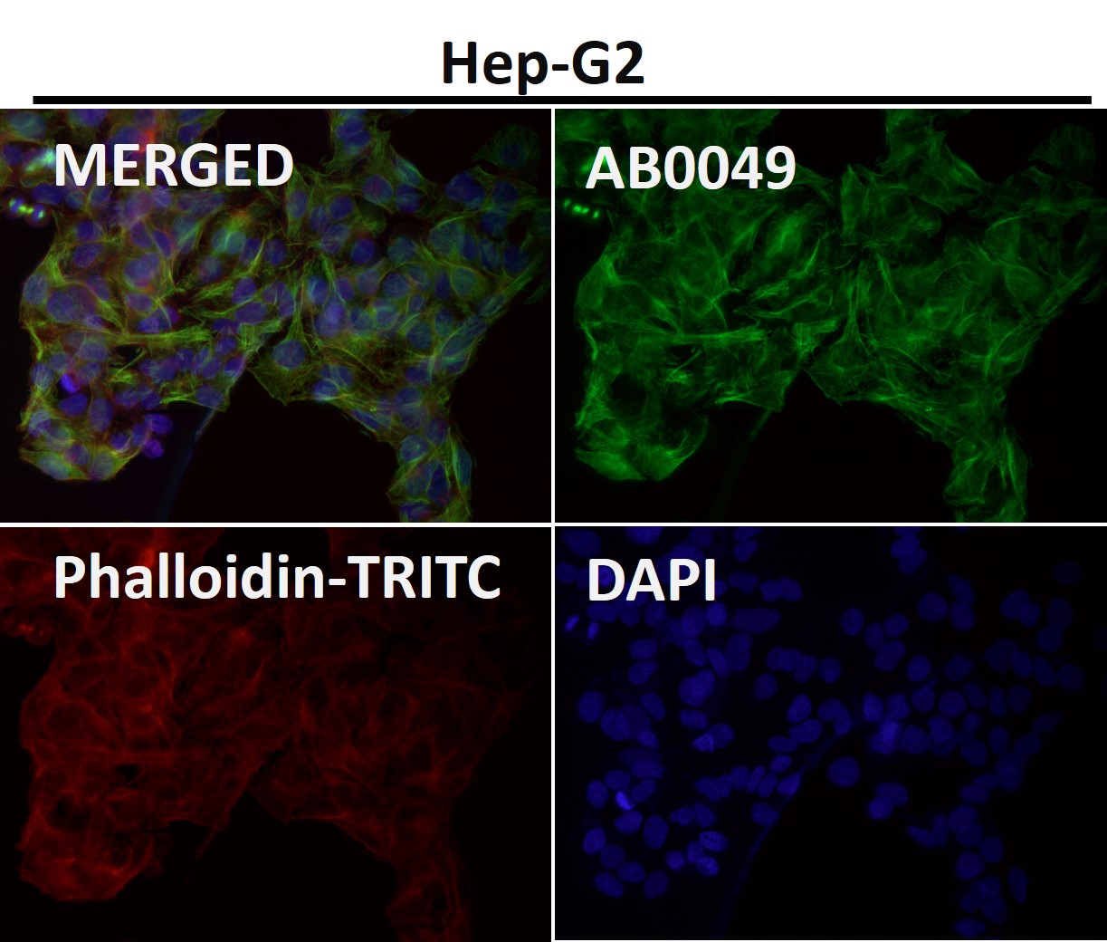 alpha 4A Tubulin Ab