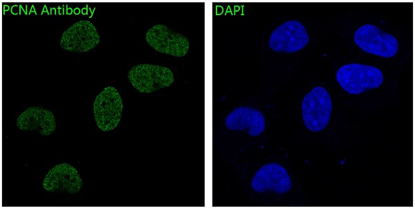PCNA Ab