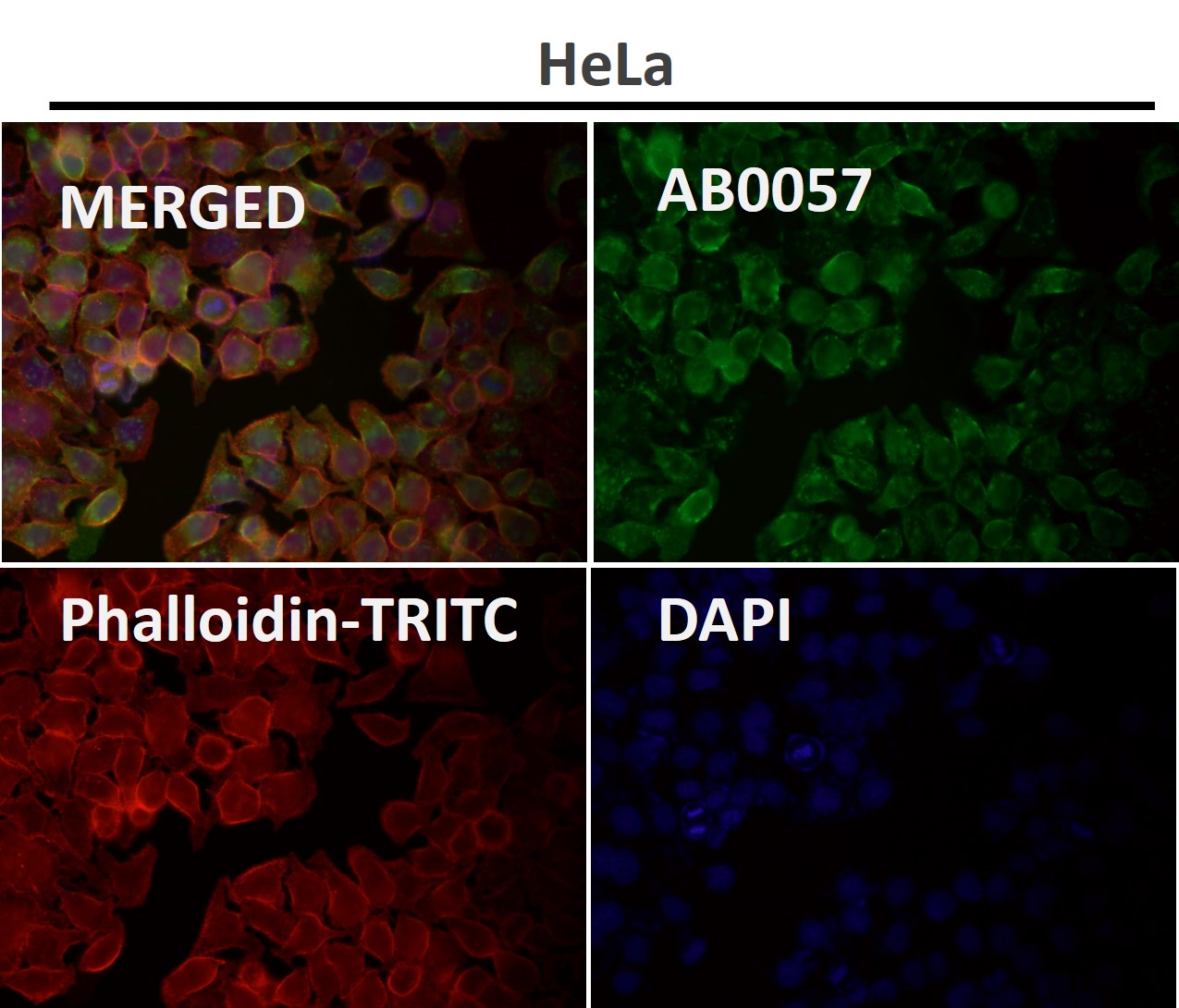 beta Tubulin Ab