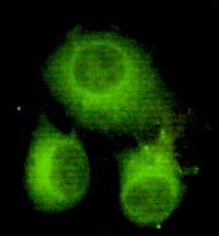 ATP citrate synthase Ab