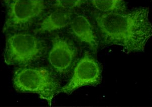 Cytokeratin 18 Ab