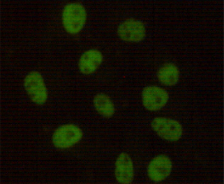 DNA PKcs Ab