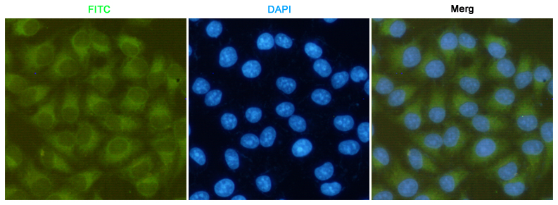 Focal adhesion kinase 1 Ab