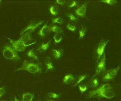 Vimentin Ab