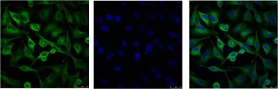 alpha 1B Tubulin Ab