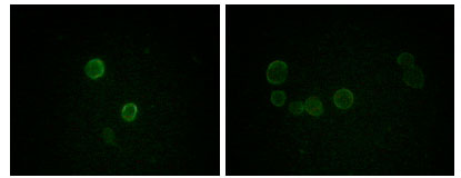 Apolipoprotein M Ab