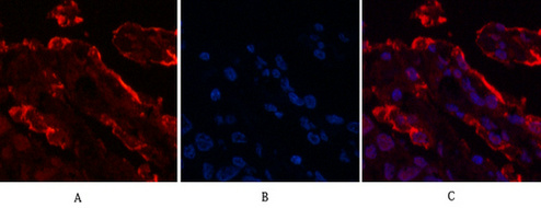 Galectin 3 Ab