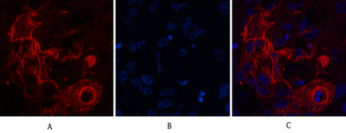 CEACAM5 Ab