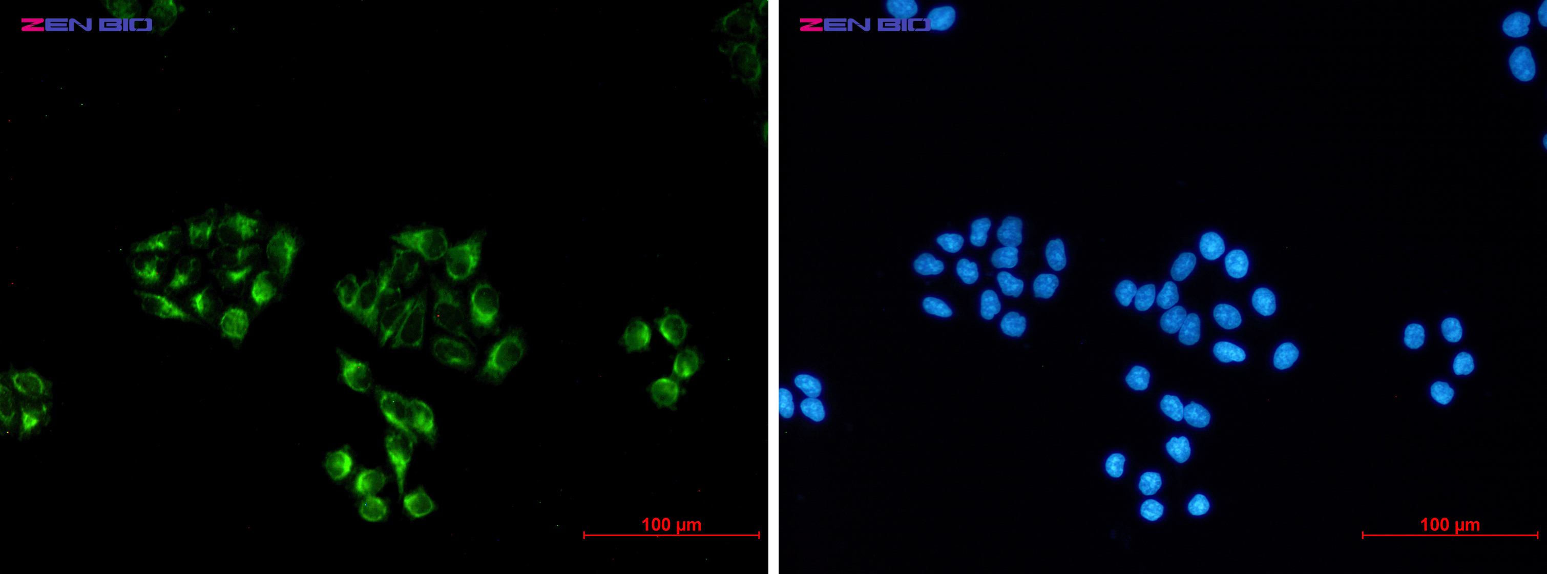 gamma Enolase Ab