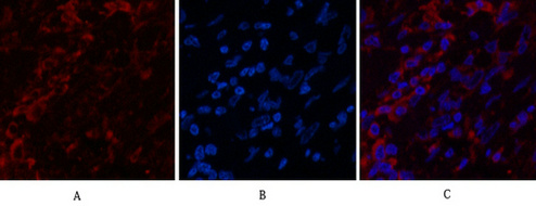 Cytokeratin 6A Ab