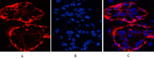 Cytokeratin 17 Ab