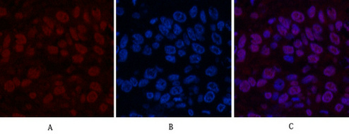 Transferrin Ab