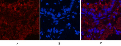 CD4 Ab