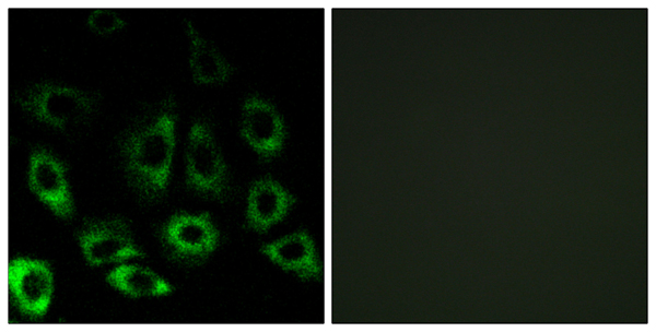 Endopeptidase S2P Ab