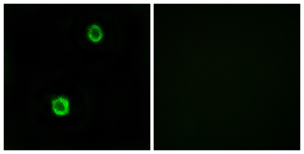 Cystatin SN Ab