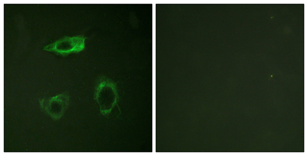 p-Integrin beta 2 (T758) Ab