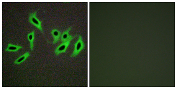 Heparin cofactor 2 Ab