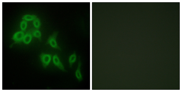 Collagen V alpha 2 Ab