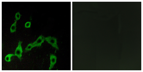 alpha 2A Adrenergic receptor Ab