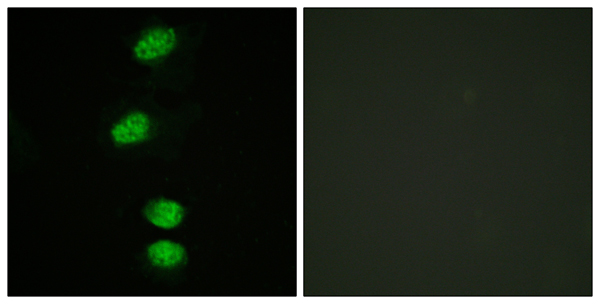 p-Androgen receptor (S96) Ab