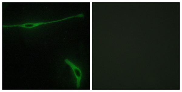 Laminin alpha 2 Ab