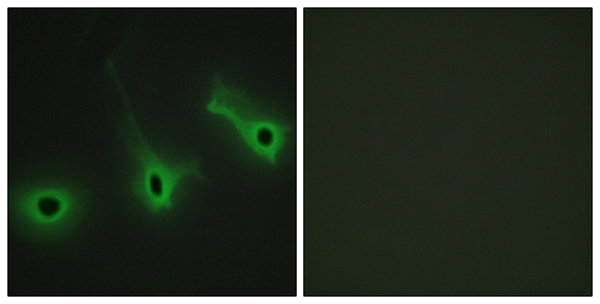 Collagen V alpha 3 Ab